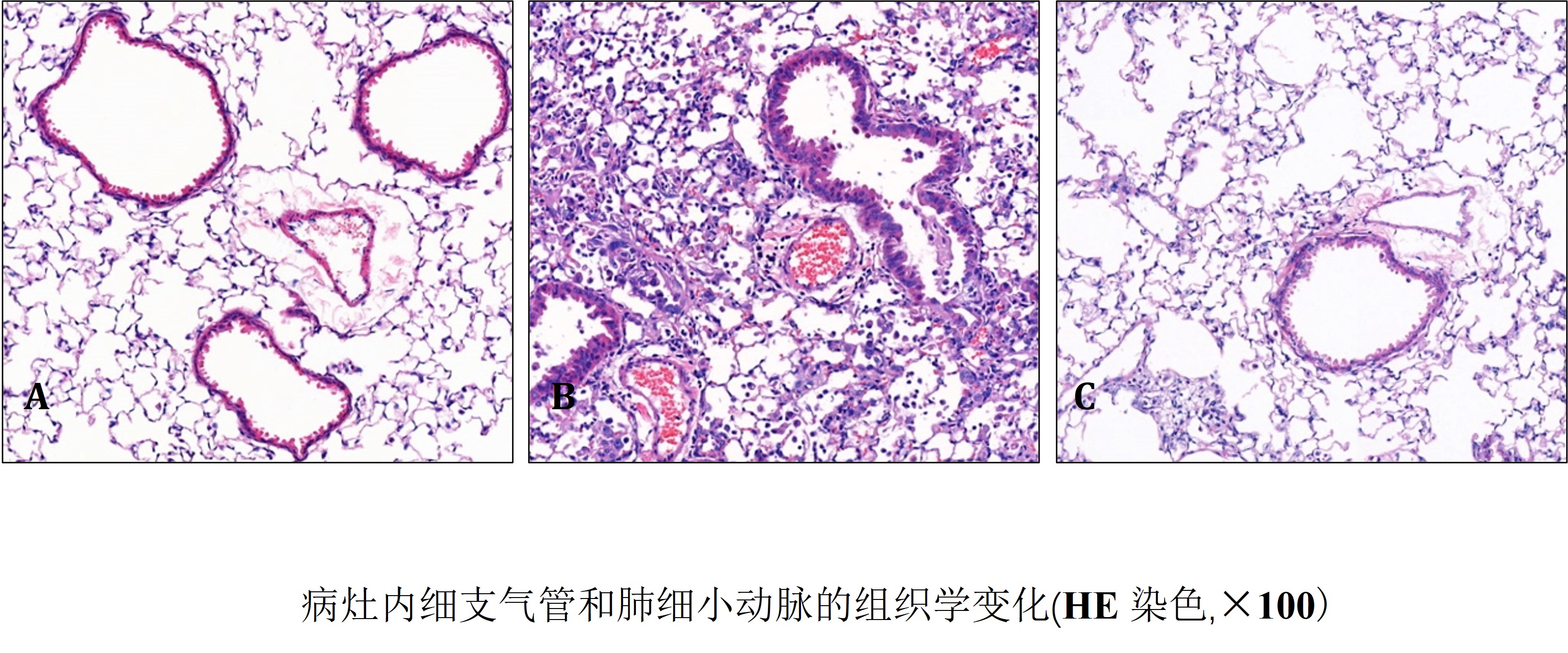 肺-2.jpg